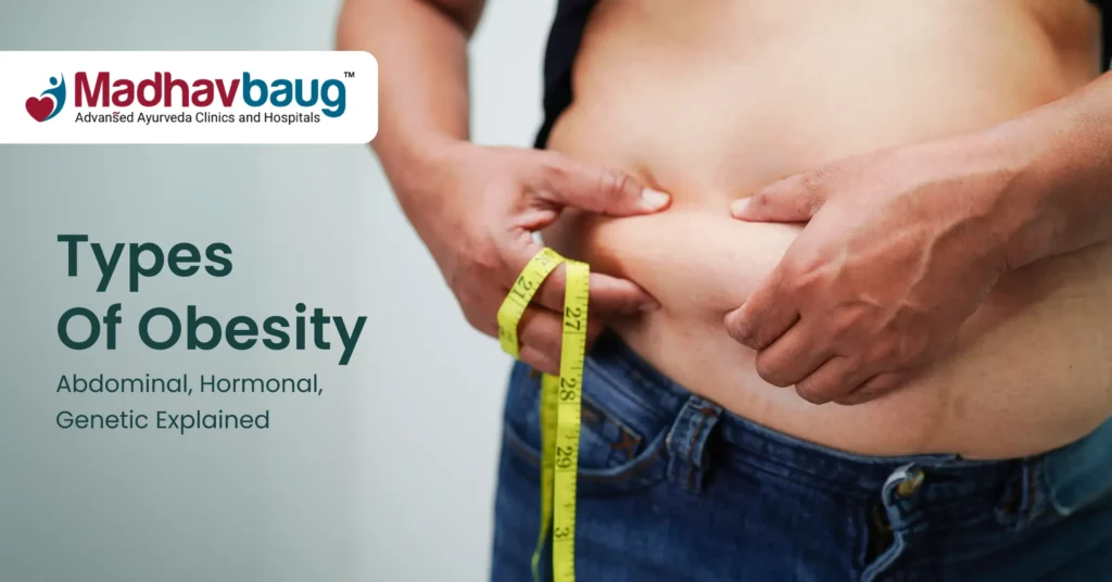 Copy of Types of obesity